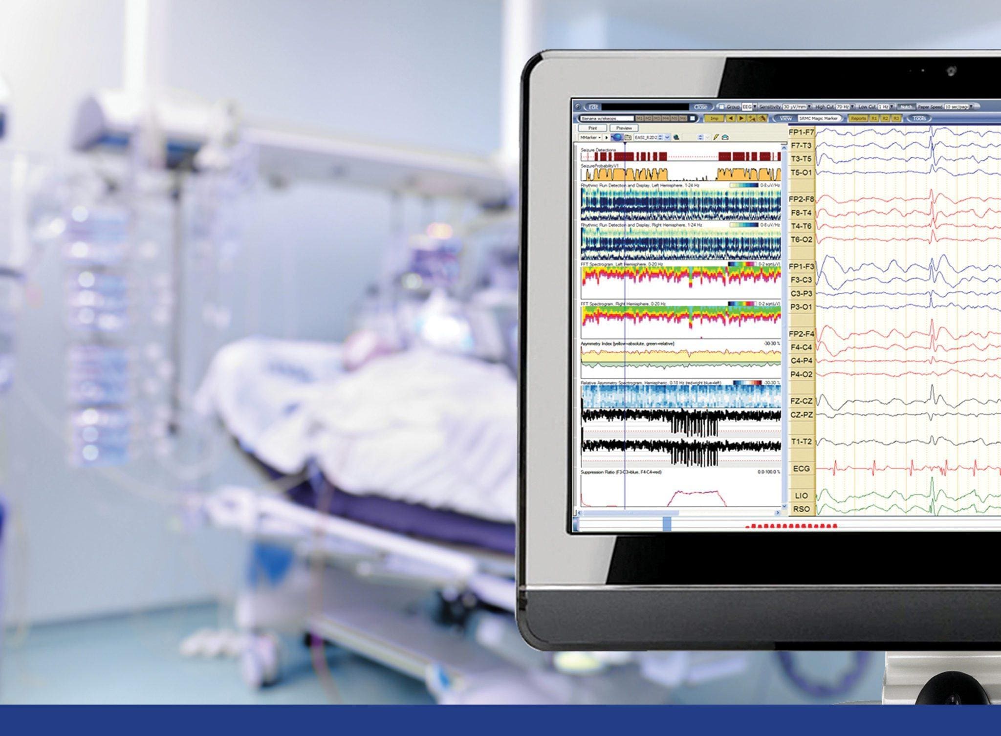 Eeg reader software Eeg reader software