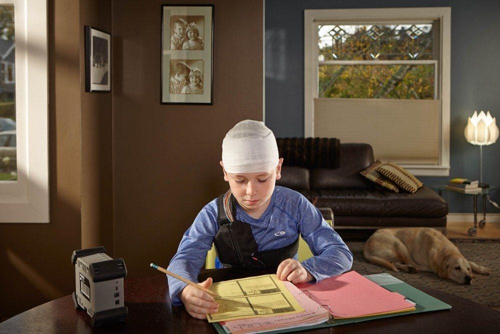 ambulatory eeg
