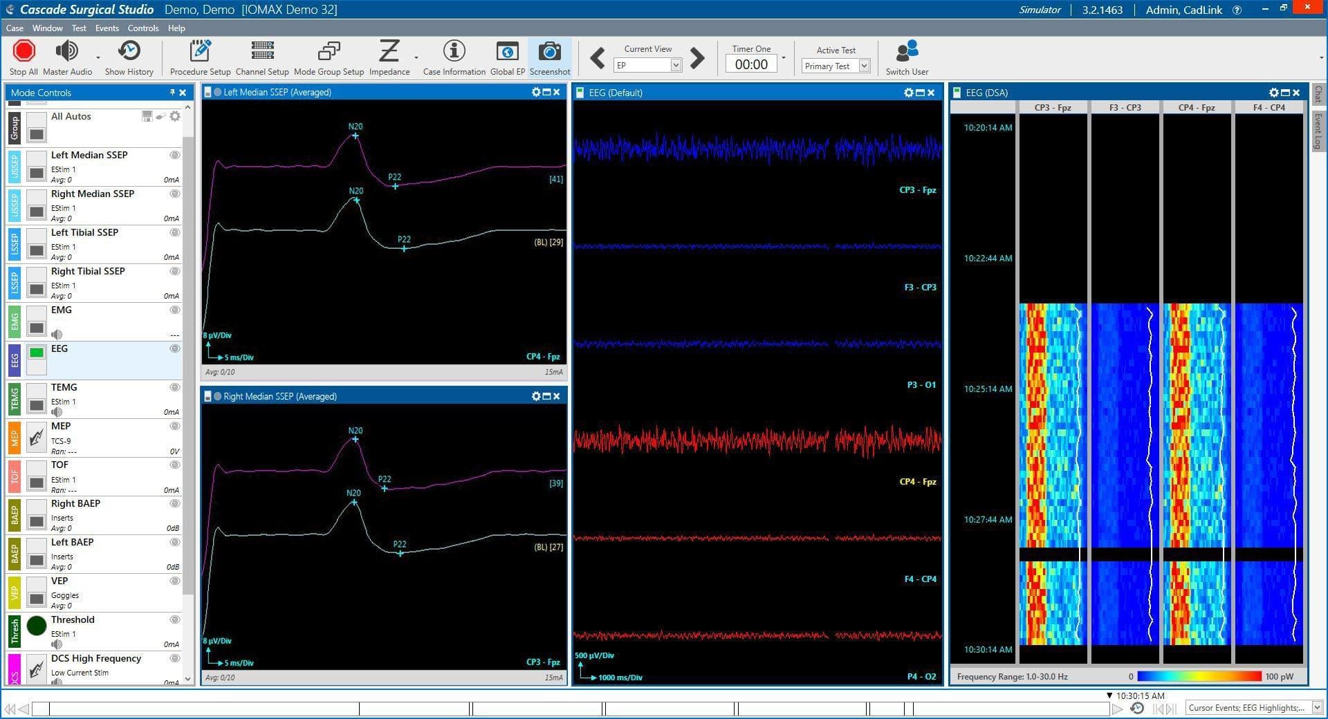 IONM CSS Monitor all modalities ionm software Monitor all Modalities IONM software