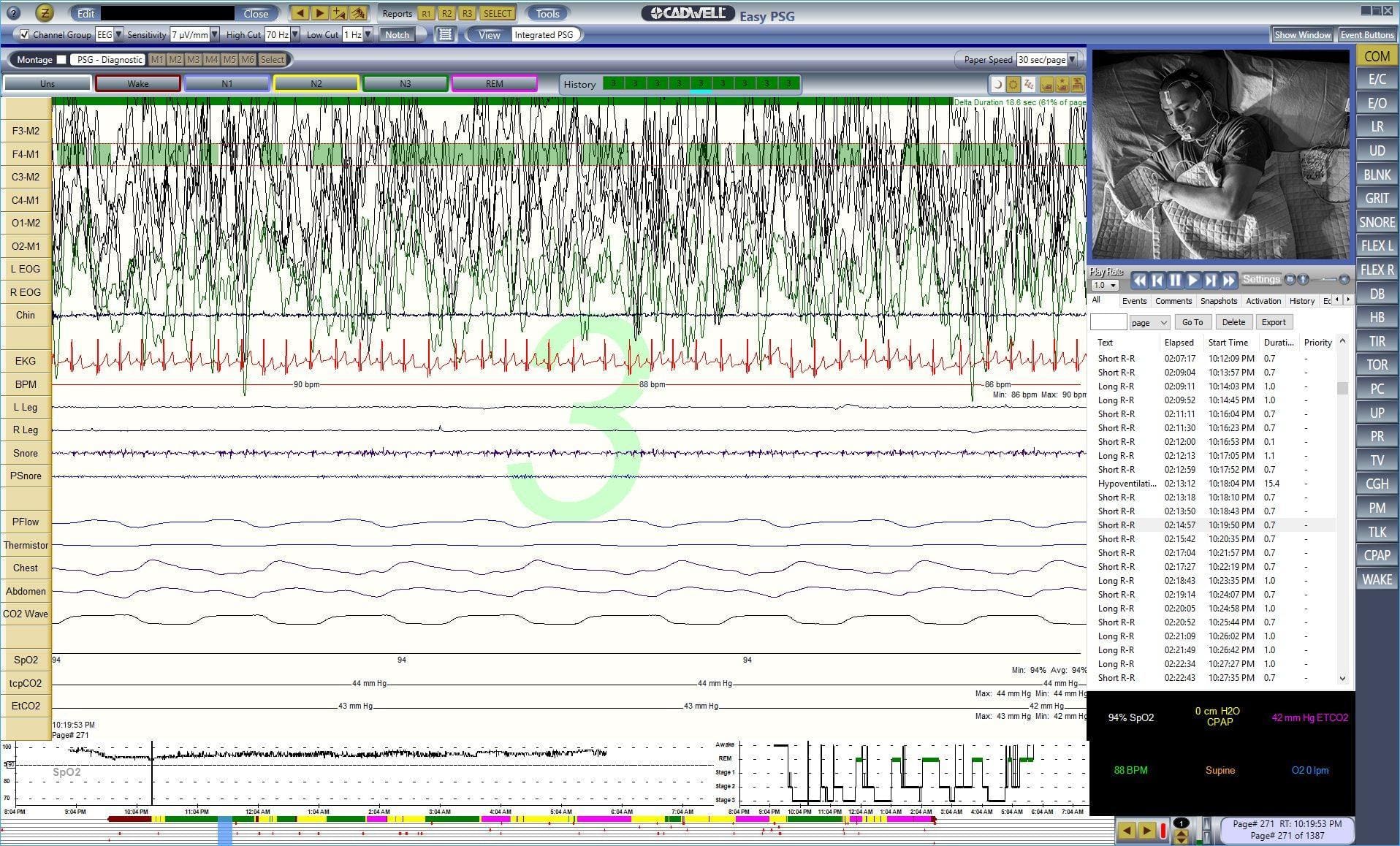 Eeg Software Download Eeg Software Download