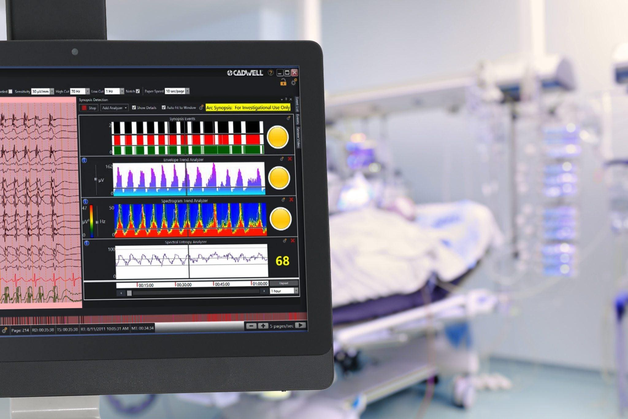 Arc EEG Synopsis Seizure Detection and Trends