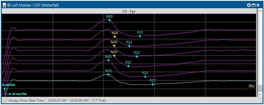 Horizontal cursor alerts IONM software CSS Set up color-changing cursor alerts