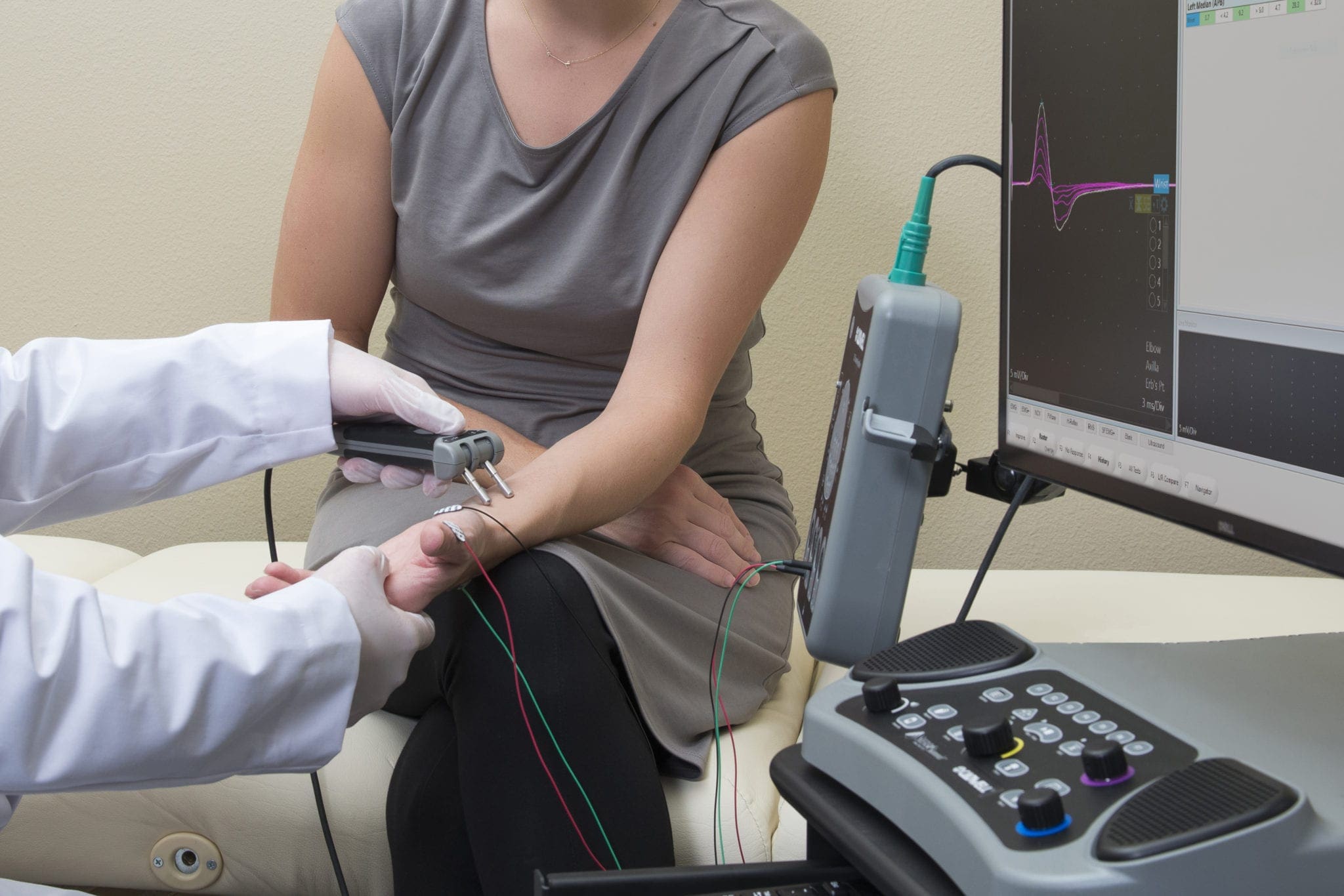 Nerve Conduction on the 3-12 channel Sierra Summit Sierra Summit NCS+ Nerve Conduction Study