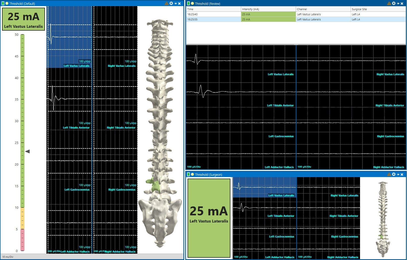 IONM software: Cascade Surgical Studio software:Efficiently pinpoint responses with Automatic Threshold mode 