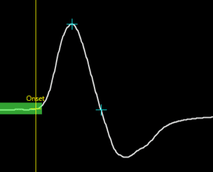 Show Ref Limits Latency