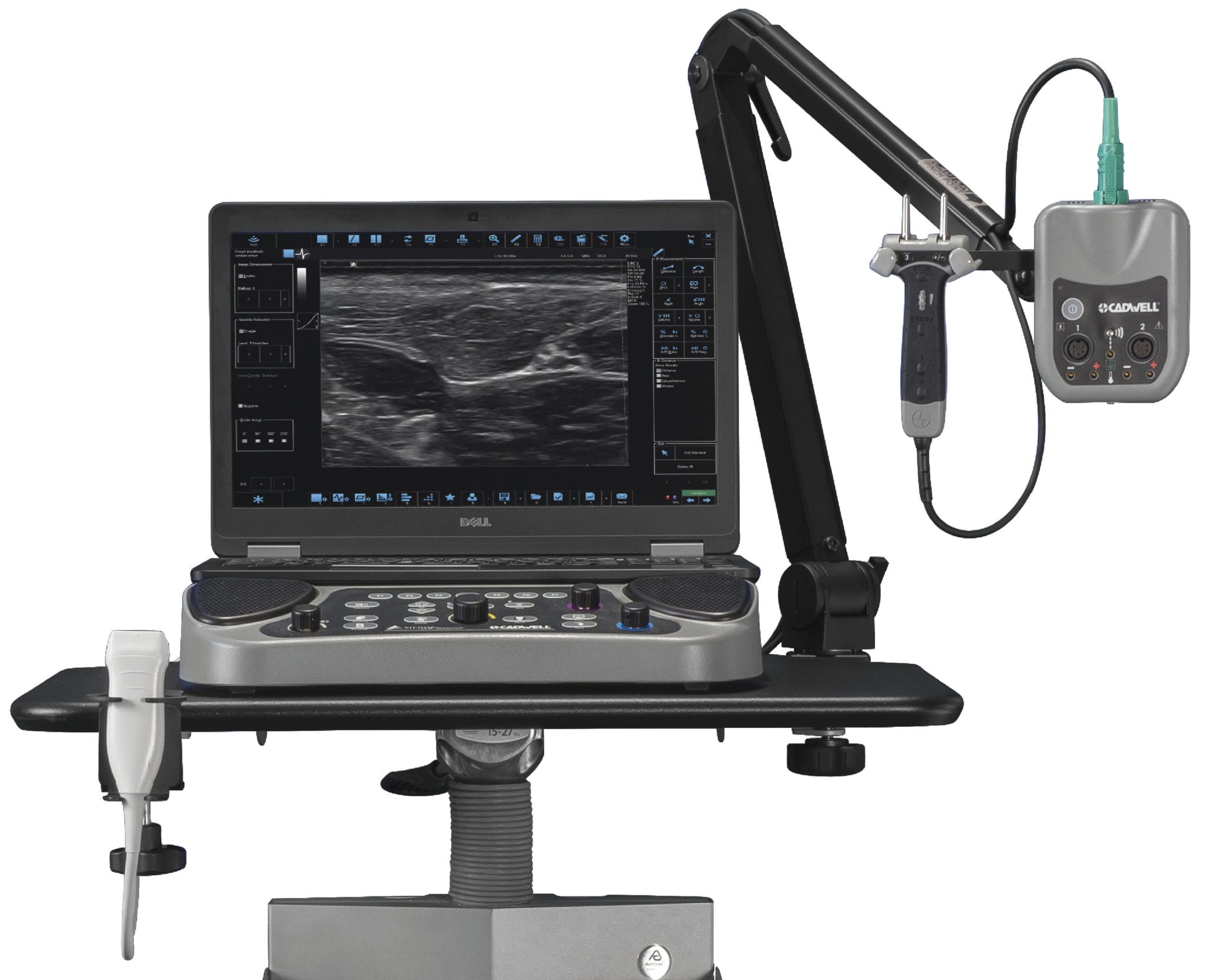 Chemodenervation Procedures Cadwell Industries, Inc.