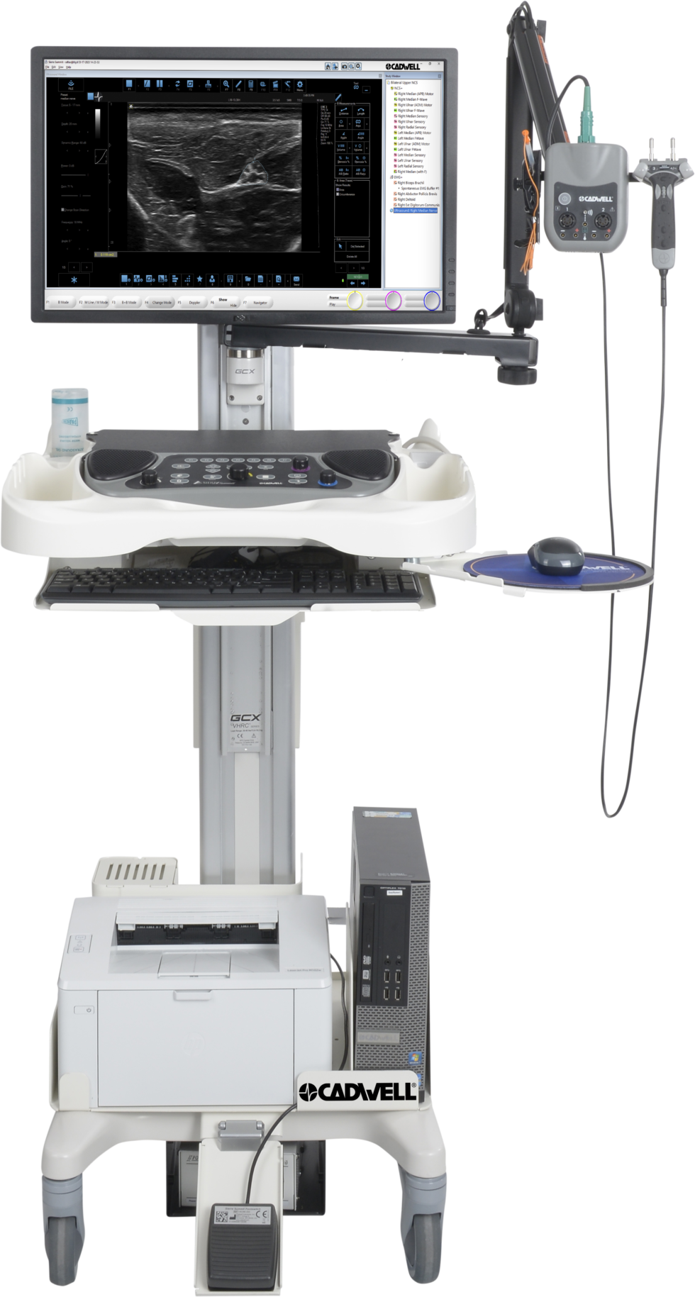 Neurodiagnostic Ultrasound Cadwell Industries, Inc.