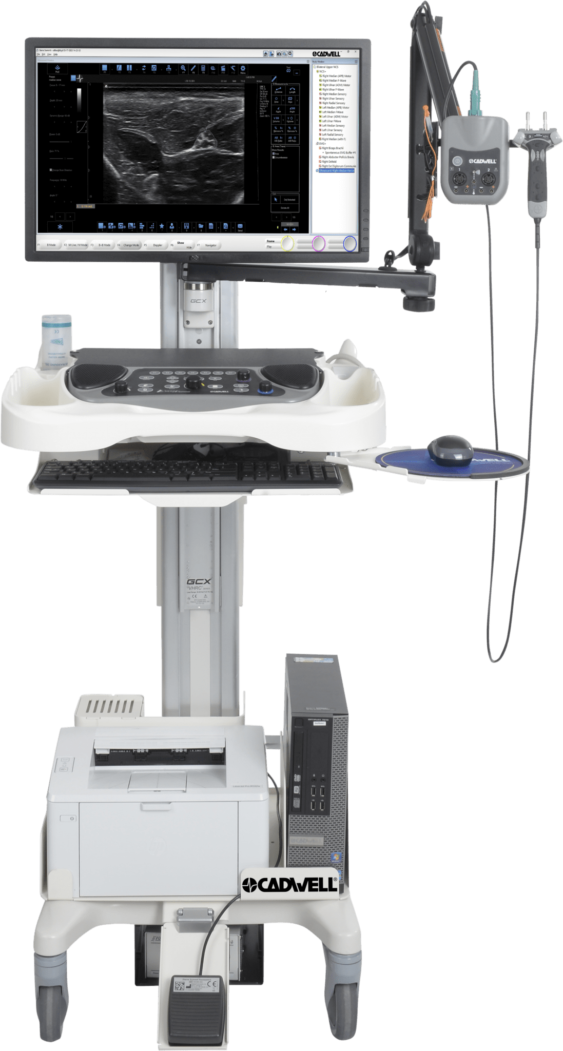 EMG Cart 2-channel Summit and Ultrasound Sierra Summit with ultrasound, a completely integrated electrodiagnostic and imaging solution. Two ultrasound options with a variety of transducers will fit your needs and your budget.