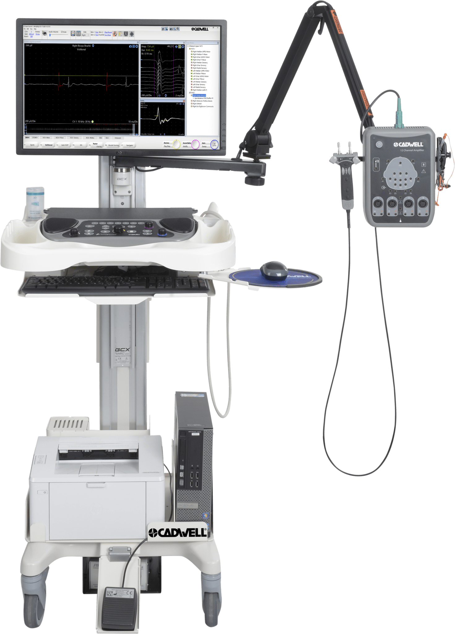 Cadwell EMG Cart with 12-ch Sierra Summit and integrated ultrasound