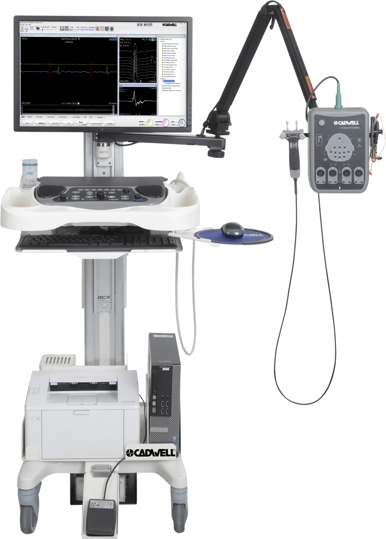 EMG cart with Summit and ultrasound