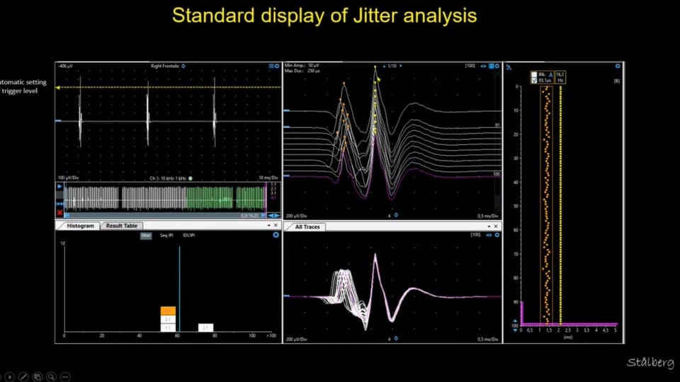 Webinar archives eeg emg ncs ionm sleep webinars