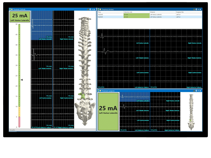 IONM-cascade-surgical-studio