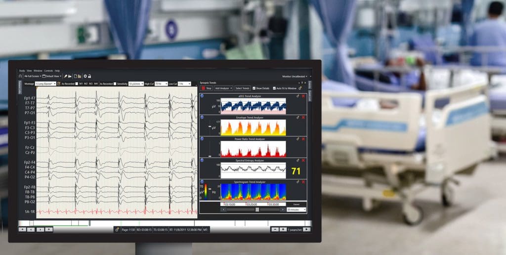arc-monitoring-icu Cadwell EEG Sentinel Monitoring