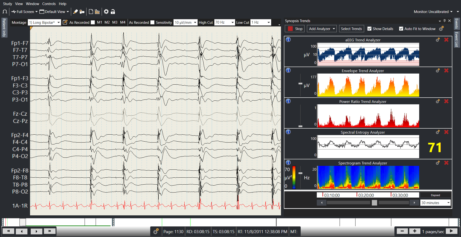Synopsis Synopsis Trends and Seizure Detection