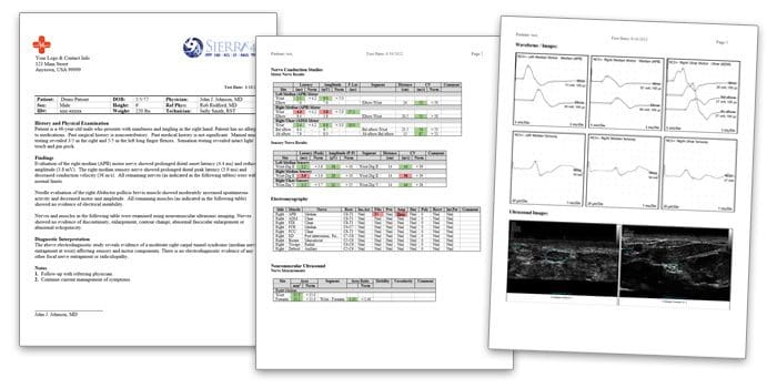 Sierra Sample Report