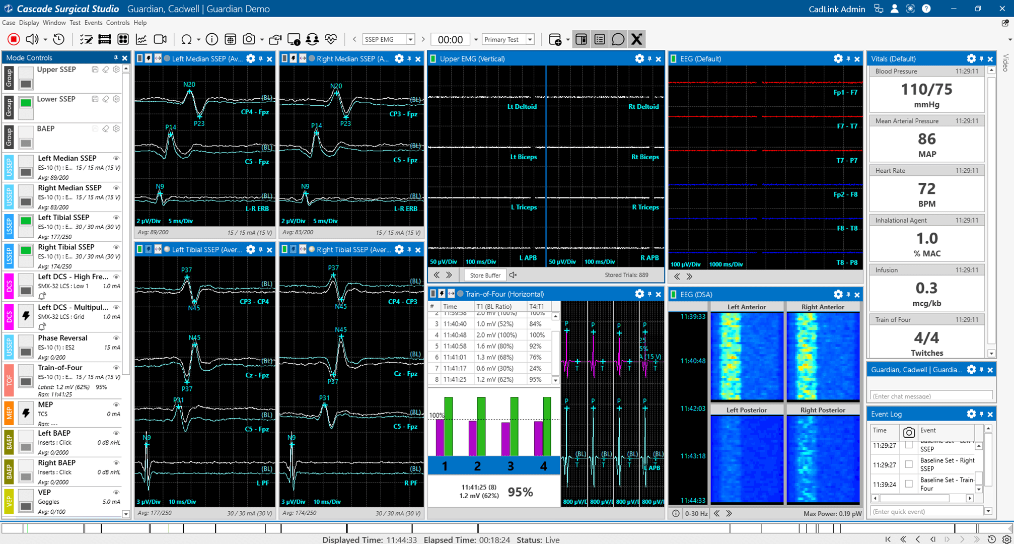 full screen_demo dark IONM-cascade-surgical-studio